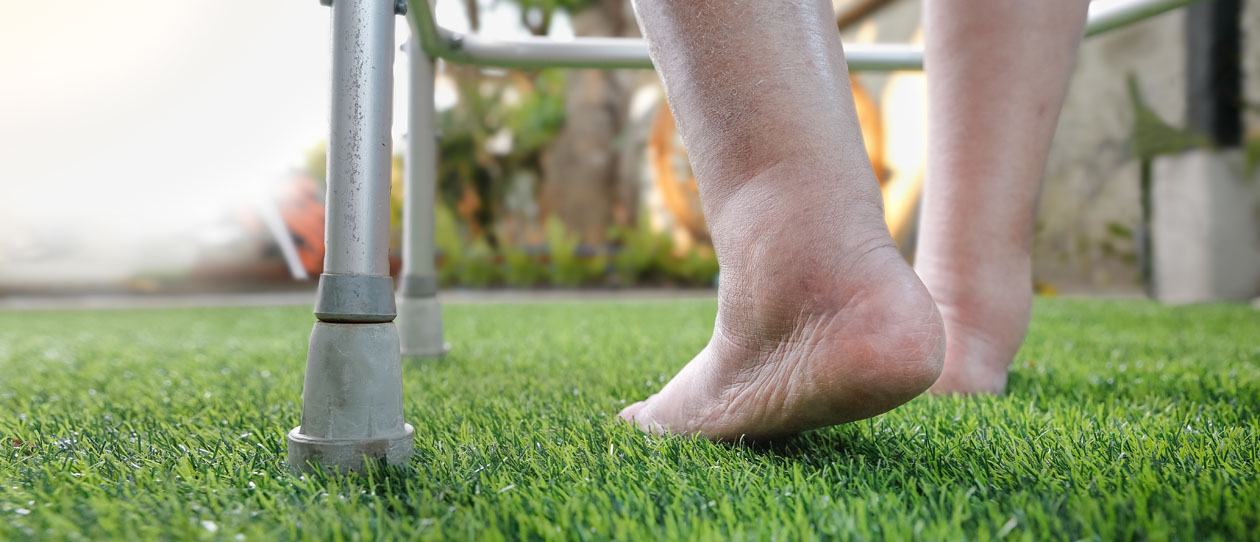 Fluid Retention